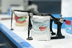 Dentures being crafted at dental lab
