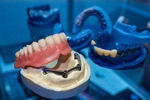 Denture being crafted at lab