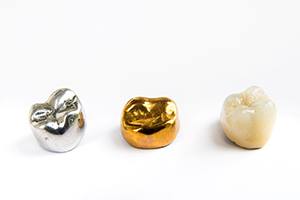 Dental crowns made of different materials