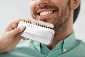 Man finding what color his dental crown should be